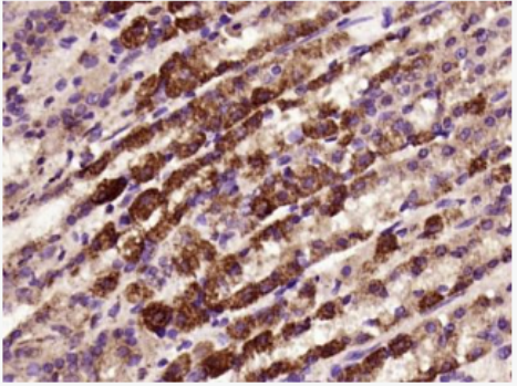 Anti-FAM83H antibody-FAM83H蛋白抗體,FAM83H