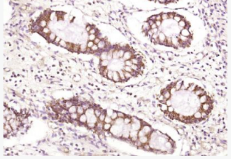 Anti-FMNL3 antibody-FMNL3蛋白抗体,FMNL3