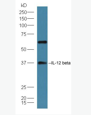 Anti-IL-12 beta antibody-白細(xì)胞介素12 β亞基蛋白抗體,IL-12 beta