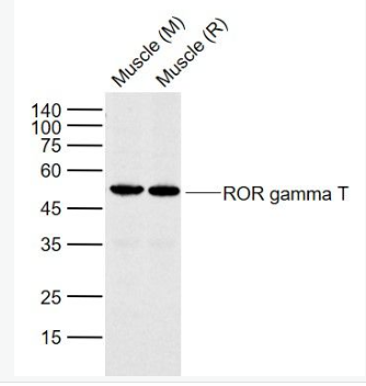 Anti-ROR gamma T antibody-维甲酸相关孤儿受体γt抗体,ROR gamma T