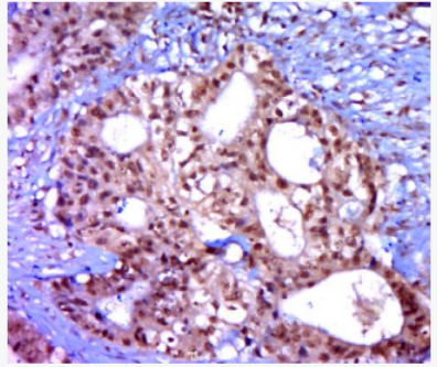 Anti-phospho-eIF2B epsilon (Ser539) antibody-磷酸化eIF2B蛋白抗體,phospho-eIF2B epsilon (Ser539)