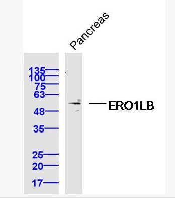 Anti-ERO1LB antibody-Ero1-Lβ蛋白抗体,ERO1LB