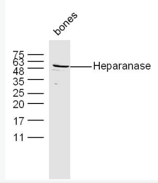 Anti-Heparanase antibody-乙酰肝素酶抗體,Heparanase