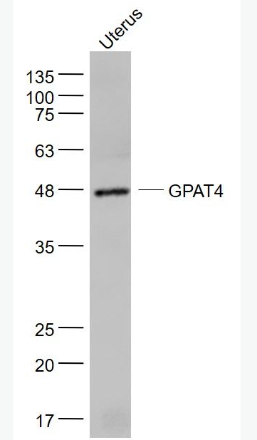 Anti-GPAT4 antibody-甘油-3-磷酸酰基轉(zhuǎn)移酶4抗體,GPAT4