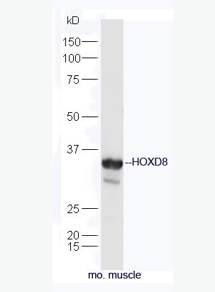 Anti-HOXD8 antibody-同源盒轉(zhuǎn)錄因子8抗體,HOXD8