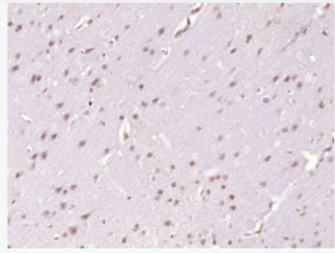 Anti-TBX3 antibody-轉(zhuǎn)錄因子Tbx3抗體,TBX3