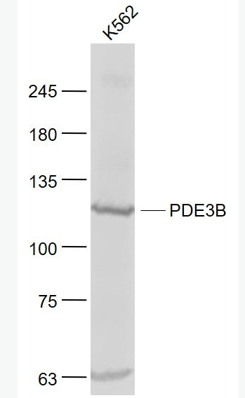 Anti-PDE3B  antibody-环核苷酸磷酸二酯酶PDE3B抗体,PDE3B