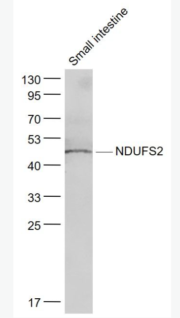 Anti-NDUFS2 antibody-NDUFS2抗體,NDUFS2