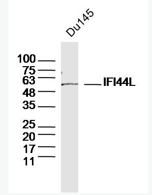 Anti-IFI44L antibody-干扰素诱导蛋白44样蛋白抗体,IFI44L