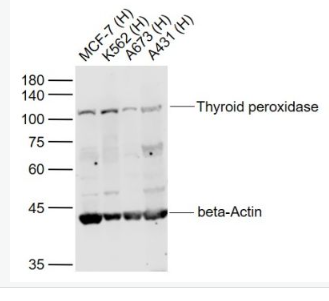 Anti-Thyroid peroxidase antibody-甲状腺过氧化物酶抗体,Thyroid peroxidase