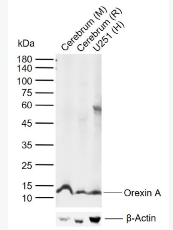 Anti-Orexin A antibody-增食欲素A/欲激素A抗体,Orexin A