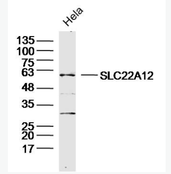 Anti-SLC22A12 antibody-尿酸盐重吸收转运子1抗体,SLC22A12