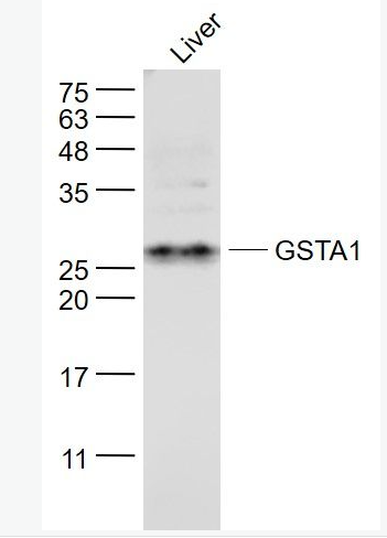 Anti-GSTA1  antibody-谷胱甘肽S转移酶α1抗体,GSTA1