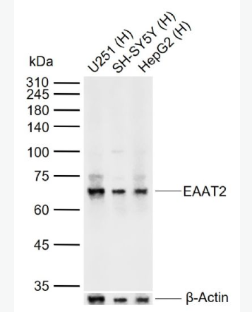 Anti-EAAT2 antibody-膠質(zhì)細(xì)胞谷氨酸運(yùn)載蛋白2抗體,EAAT2