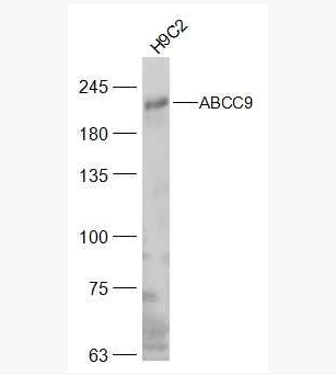 Anti-ABCC9 antibody-ATP結合盒轉運家族蛋白9抗體,ABCC9