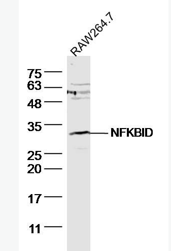 Anti-NFKBID antibody-核因子κB抑制蛋白δ抗体,NFKBID