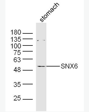 Anti-SNX6 antibody-分選連接蛋白6抗體,SNX6