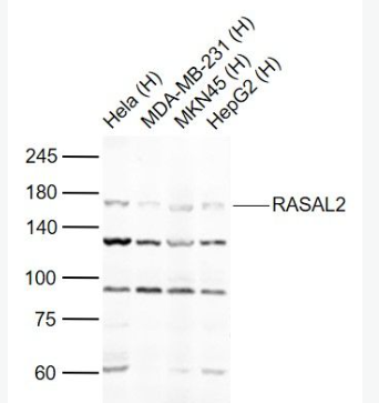 Anti-RASAL2 antibody-RASAL2蛋白抗体,RASAL2