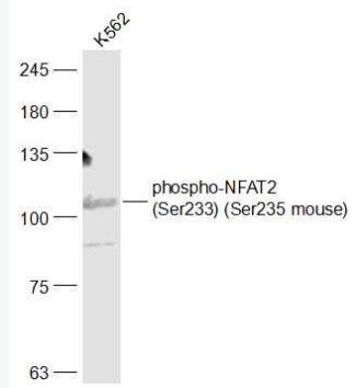 Anti-phospho-NFAT2 (Ser233) antibody-磷酸化活化T細(xì)胞核因子1蛋白抗體,phospho-NFAT2 (Ser233)