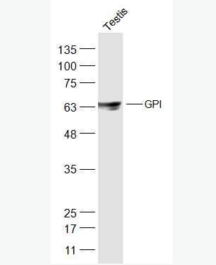 Anti-GPI antibody-糖磷脂酰肌醇抗体,GPI