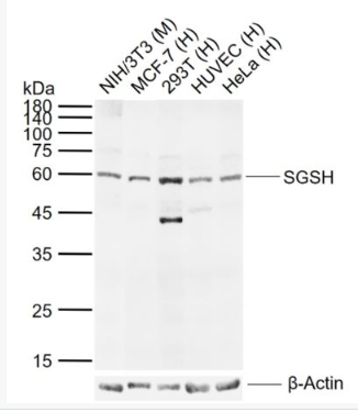 Anti-SGSH antibody-磺氨基葡糖硫酸胺酶抗體,SGSH