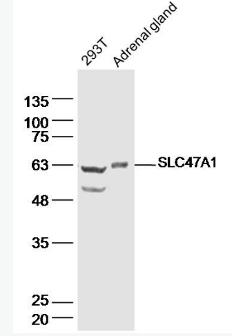Anti-SLC47A1 antibody-溶质载体蛋白家族47成员A1抗体,SLC47A1