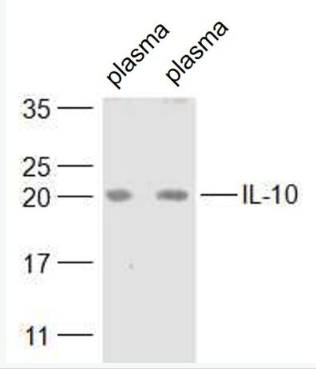 Anti-IL-10 antibody-白细胞介素10抗体,IL-10