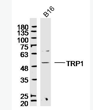 Anti-TYRP1 antibody-酪氨酸酶相關(guān)蛋白1抗體,TYRP1