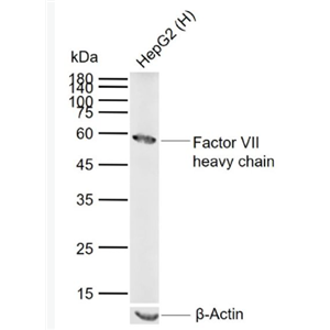 Anti-Factor VII heavy chain antibody-凝血因子7抗体
