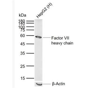 Anti-Factor VII heavy chain antibody-凝血因子7抗体,Factor VII heavy chain