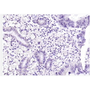 Anti-FIGNL1 antibody-FIGNL1蛋白抗体