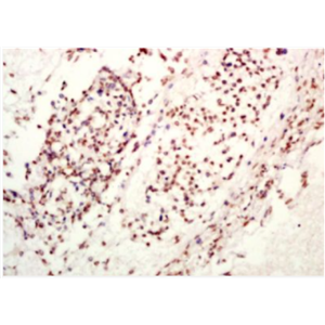 Anti-TET1 antibody-Ten-eleven轉(zhuǎn)運(yùn)基因1蛋白抗體,TET1