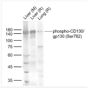Anti-phospho-CD130/gp130 (Ser782) antibody-磷酸化gp130抗体