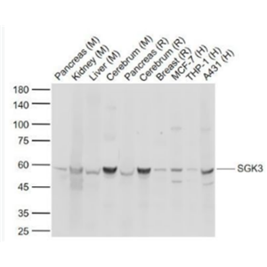 Anti-SGK3 antibody-丝氨酸/苏氨酸蛋白激酶Sgk3抗体