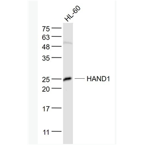 Anti-HAND1  antibody-心脏和神经嵴衍生蛋白1抗体