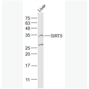 Anti-SIRT5 antibody-沉默调节蛋白5抗体