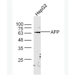 Anti-AFP antibody-甲胎蛋白AFP抗体,AFP