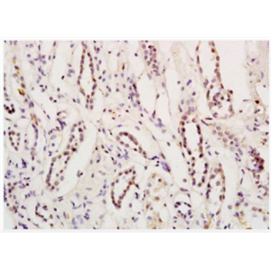 Anti-Myocardin antibody-促血管平滑肌细胞分化因子抗体