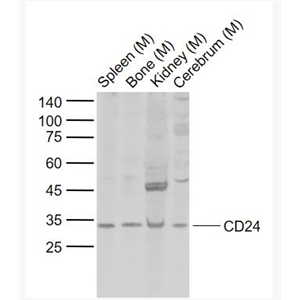 Anti-CD24 antibody-CD24抗体