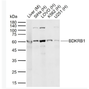 Anti-BDKRB1 antibody-缓激肽B1受体抗体