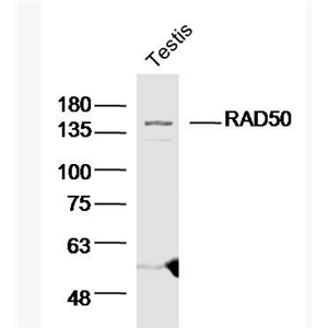 Anti-RAD50 antibody-DNA修复蛋白Rad50抗体