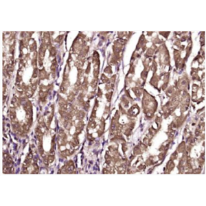 Anti-Cytohesin 2  antibody-胞粘蛋白2抗体,Cytohesin 2