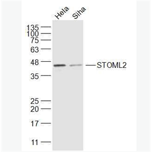 Anti-STOML2 antibody-溴化丙胺太林相关蛋白2抗体