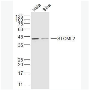 Anti-STOML2 antibody-溴化丙胺太林相关蛋白2抗体,STOML2