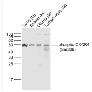 Anti-phospho-CXCR4 (Ser339) antibody-磷酸化细胞表面趋化因子受体4抗体