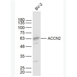 Anti-ACCN2 antibody-脑钠通道蛋白2抗体