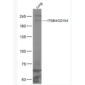 Anti-ITGB4/CD104 antibody-整合素β4抗体