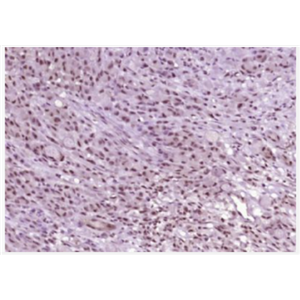 Anti-phospho-ATM (Ser794) antibody-磷酸化毛细血管扩张性共济失调症突变蛋白抗体