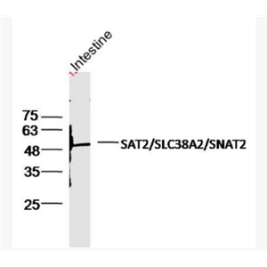 Anti-SLC38A2 antibody-氨基酸转运蛋白2抗体