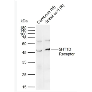 Anti-5HT1D Receptor  antibody-5-羟色胺受体1D抗体,5HT1D Receptor